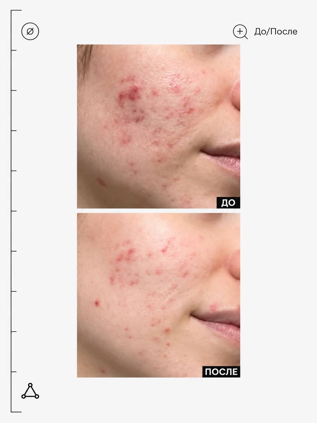 Allies of Skin Ночная маска с кислотами против несовершенств Promise Keeper Nightly Blemish Treatment 48 мл